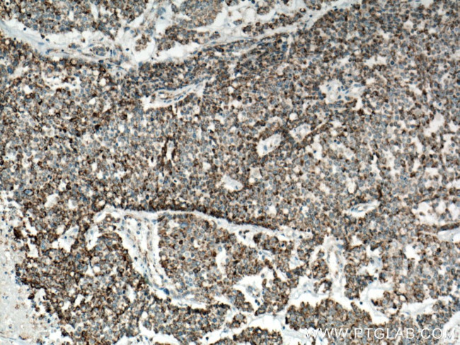 IDH2 Antibody in Immunohistochemistry (Paraffin) (IHC (P))