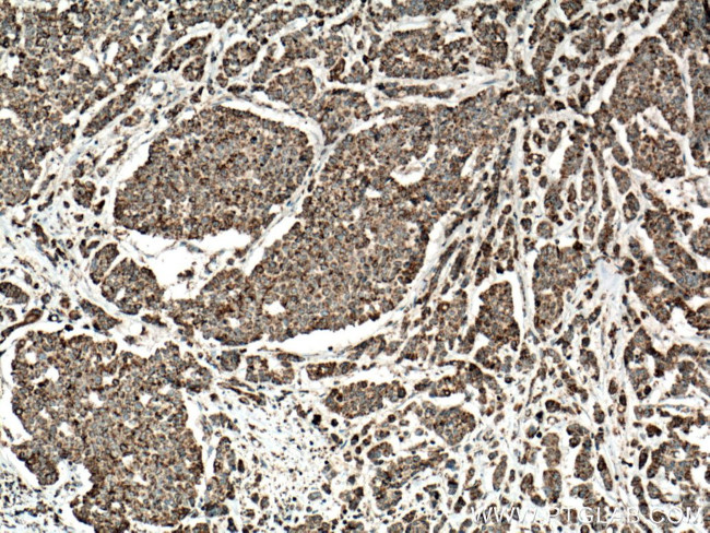 IDH2 Antibody in Immunohistochemistry (Paraffin) (IHC (P))