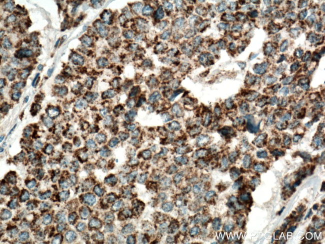 IDH2 Antibody in Immunohistochemistry (Paraffin) (IHC (P))