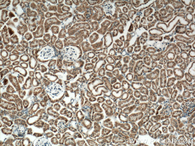 IDH2 Antibody in Immunohistochemistry (Paraffin) (IHC (P))