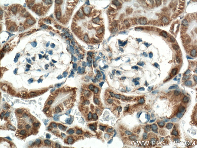 IDH2 Antibody in Immunohistochemistry (Paraffin) (IHC (P))