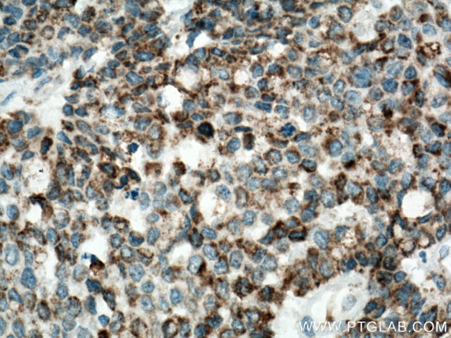 IDH2 Antibody in Immunohistochemistry (Paraffin) (IHC (P))