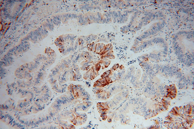 IDH2 Antibody in Immunohistochemistry (Paraffin) (IHC (P))