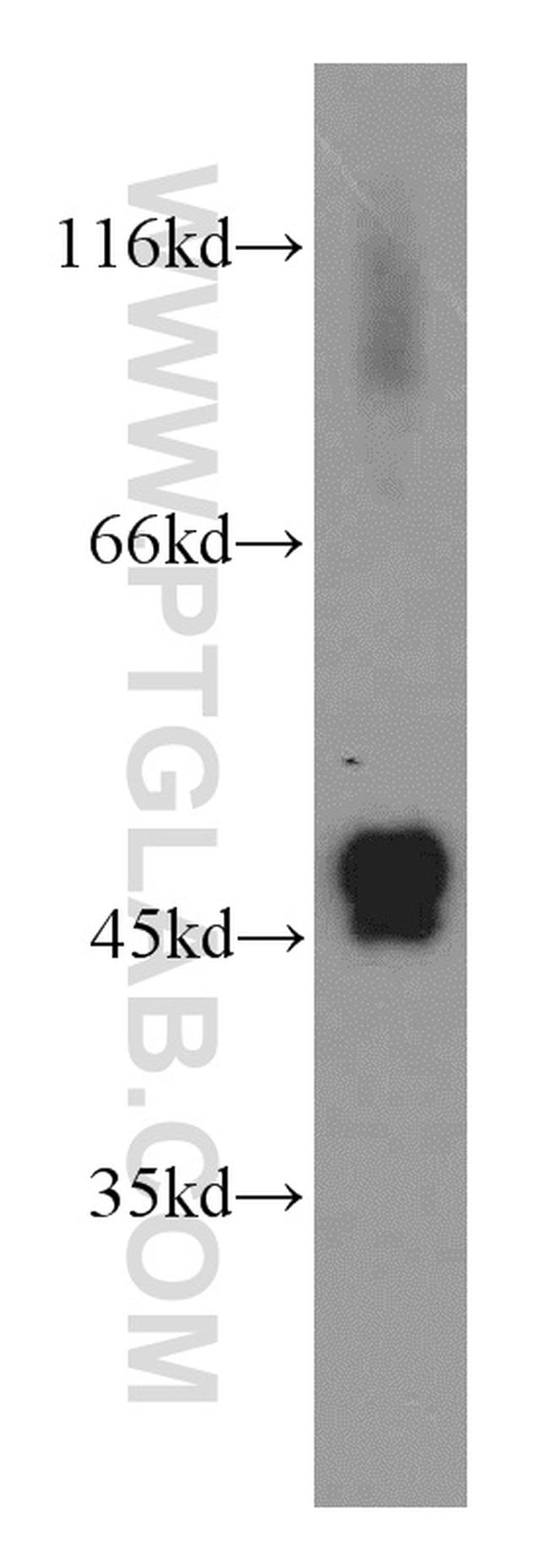 IDH2 Antibody in Western Blot (WB)