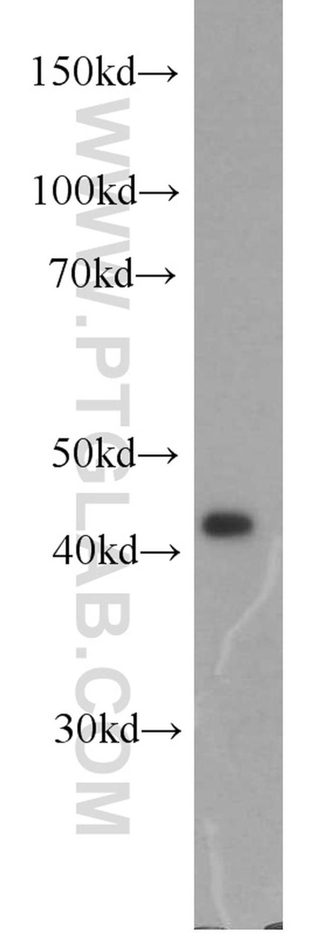 IDH2 Antibody in Western Blot (WB)