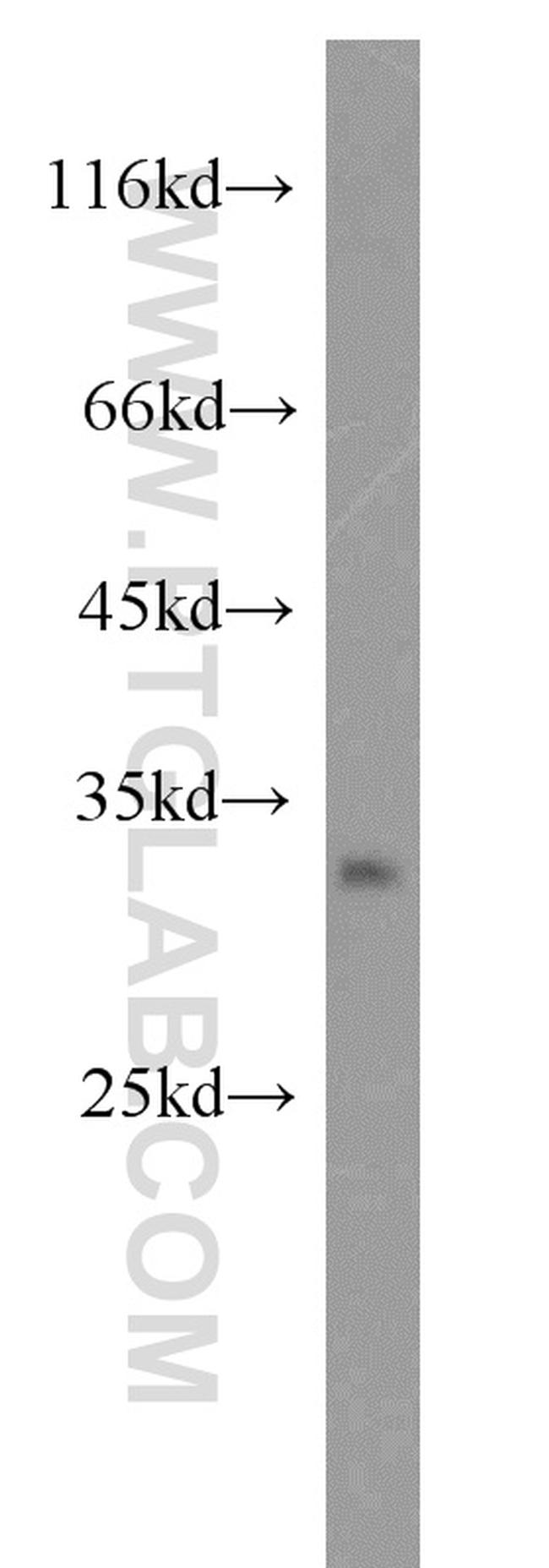 DNASE2 Antibody in Western Blot (WB)