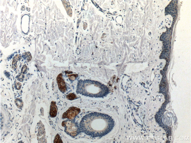 Piezo1 Antibody in Immunohistochemistry (Paraffin) (IHC (P))