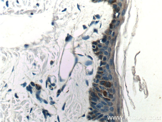 Piezo1 Antibody in Immunohistochemistry (Paraffin) (IHC (P))