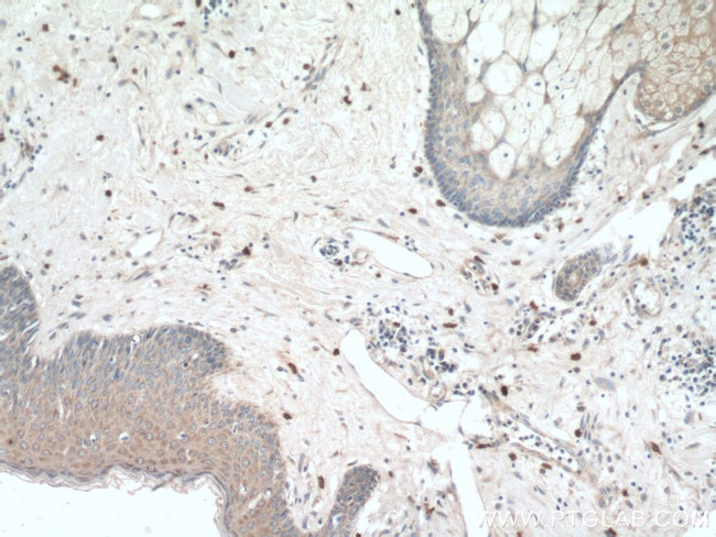 Piezo1 Antibody in Immunohistochemistry (Paraffin) (IHC (P))