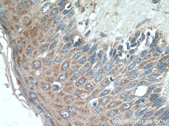 Piezo1 Antibody in Immunohistochemistry (Paraffin) (IHC (P))