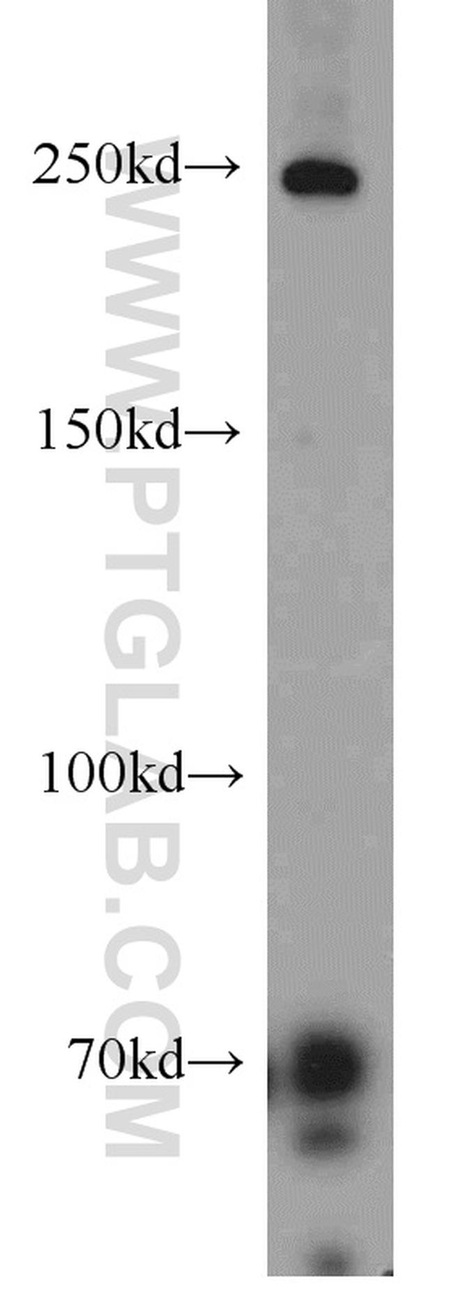 Piezo1 Antibody in Western Blot (WB)