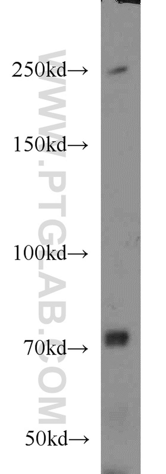 Piezo1 Antibody in Western Blot (WB)