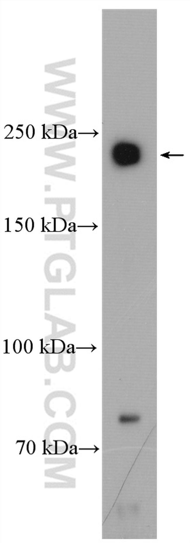 Piezo1 Antibody in Western Blot (WB)