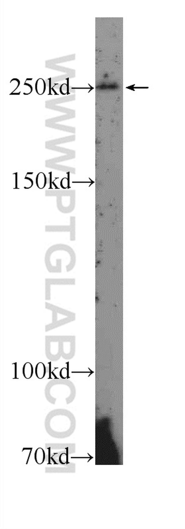 Piezo1 Antibody in Western Blot (WB)