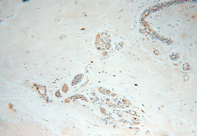 CAPZA2 Antibody in Immunohistochemistry (Paraffin) (IHC (P))