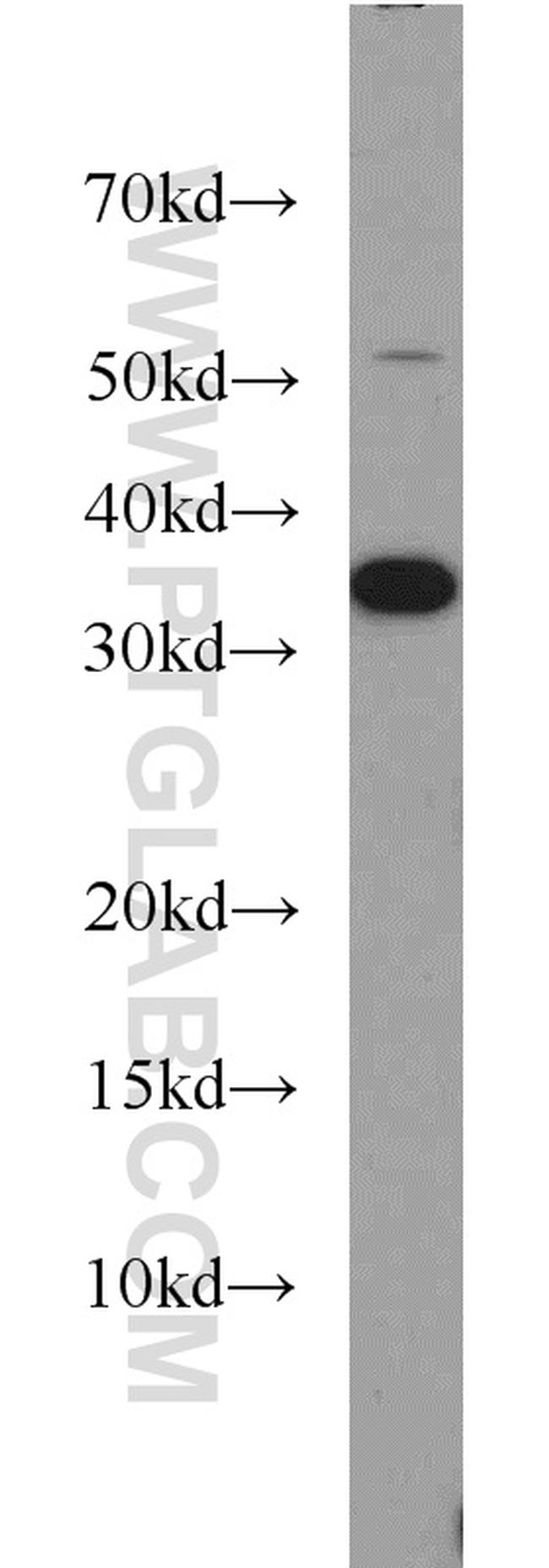 CAPZA2 Antibody in Western Blot (WB)