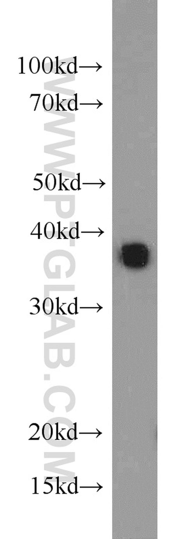 CAPZA2 Antibody in Western Blot (WB)