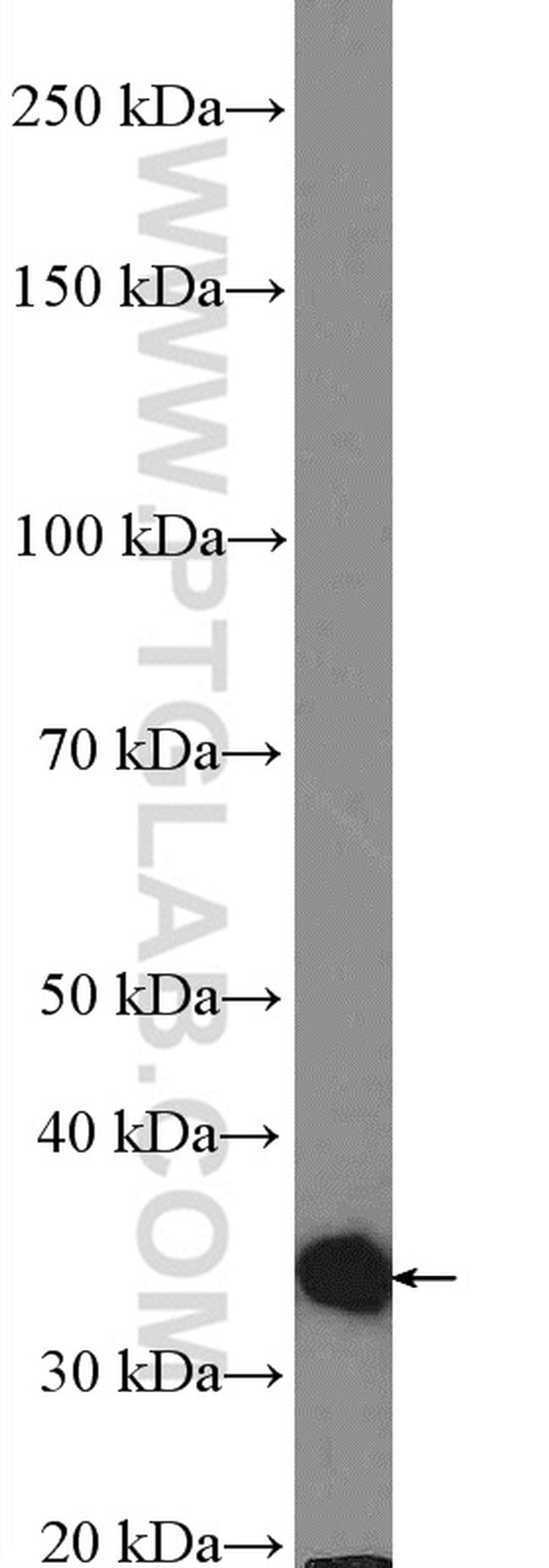 CAPZA2 Antibody in Western Blot (WB)