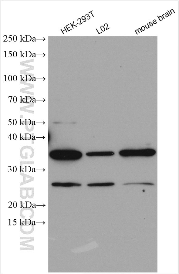 DYNC2LI1 Antibody in Western Blot (WB)