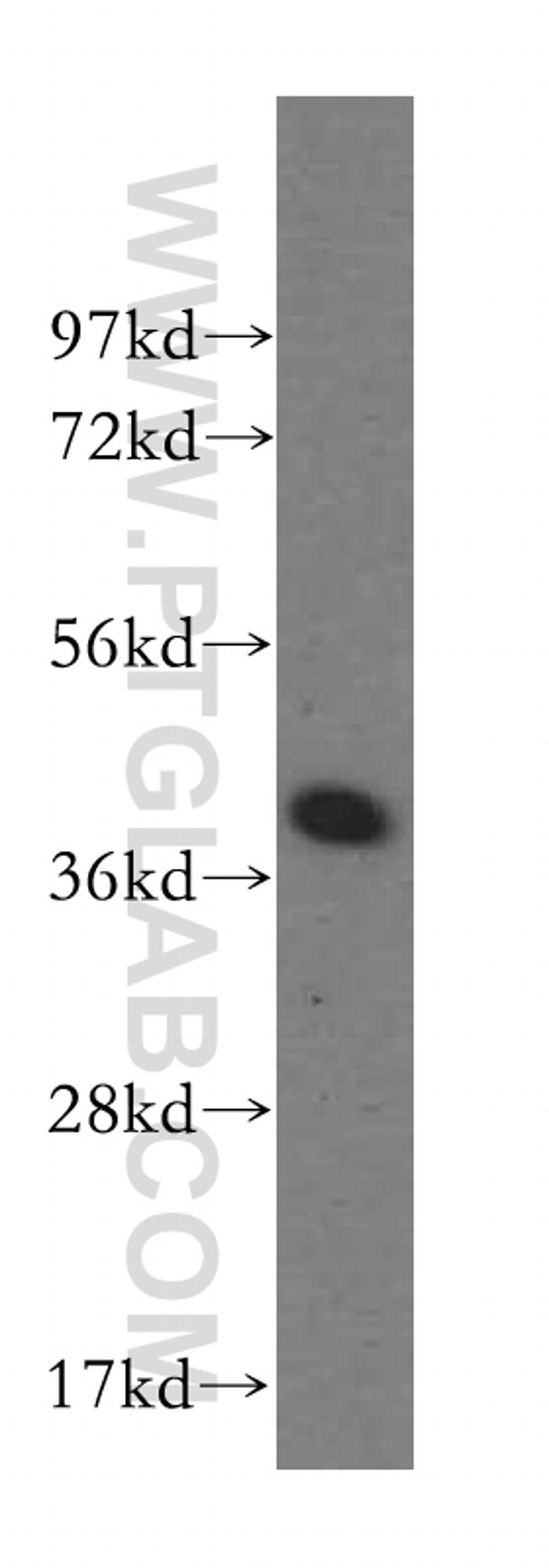 DYNC2LI1 Antibody in Western Blot (WB)