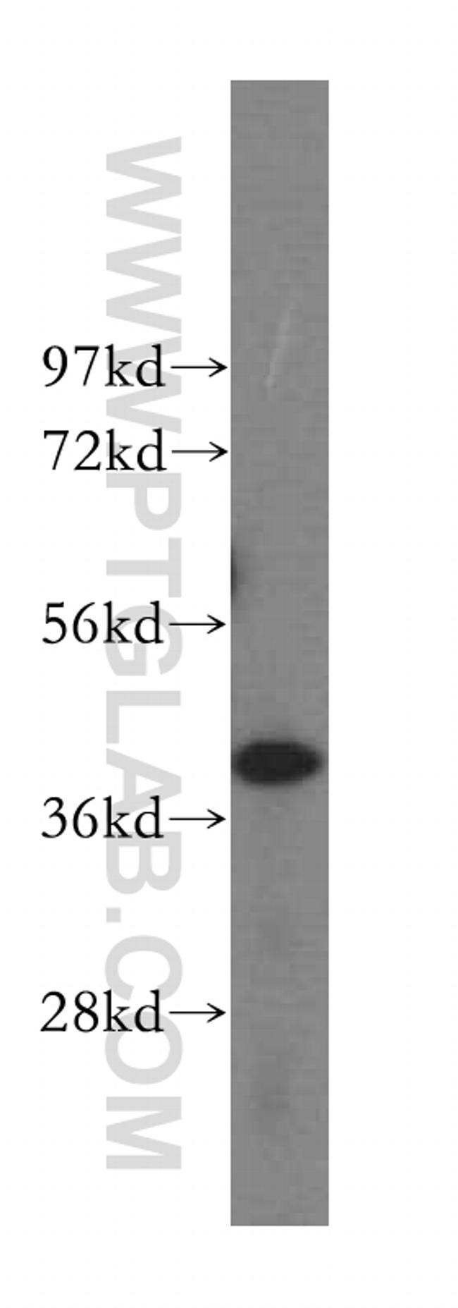 DYNC2LI1 Antibody in Western Blot (WB)