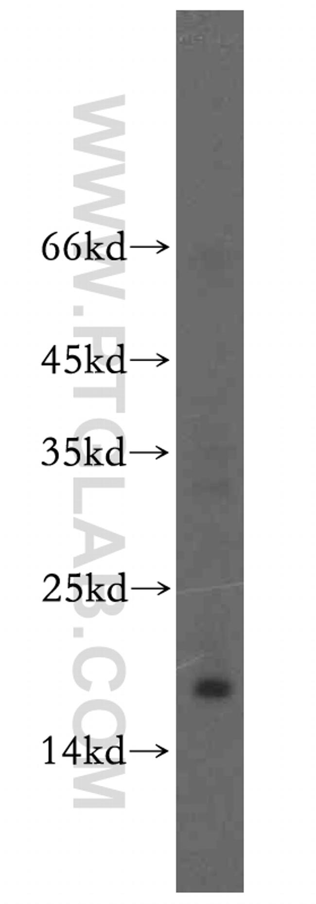 UTP23 Antibody in Western Blot (WB)