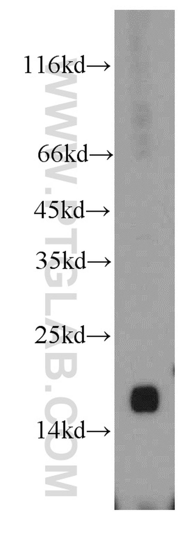 UTP23 Antibody in Western Blot (WB)