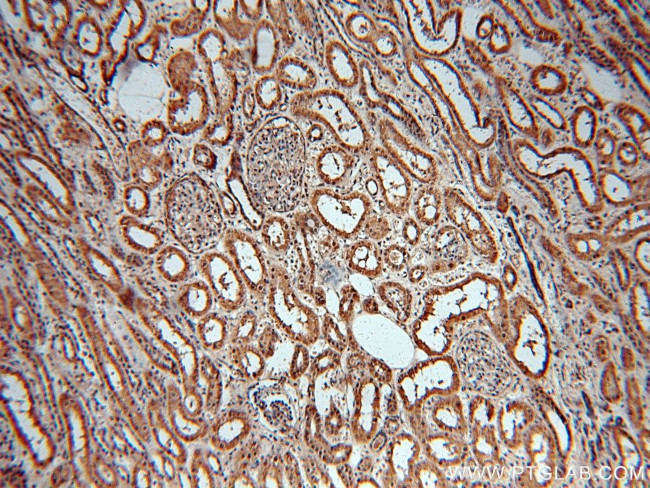 MAT2B Antibody in Immunohistochemistry (Paraffin) (IHC (P))