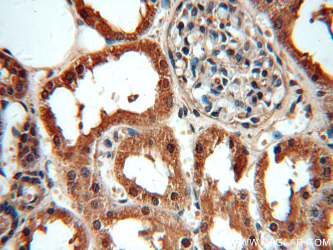 MAT2B Antibody in Immunohistochemistry (Paraffin) (IHC (P))