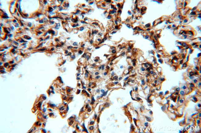 MAT2B Antibody in Immunohistochemistry (Paraffin) (IHC (P))