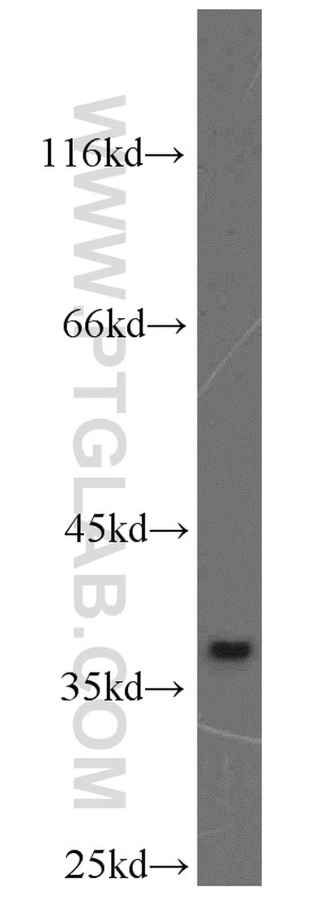 MAT2B Antibody in Western Blot (WB)