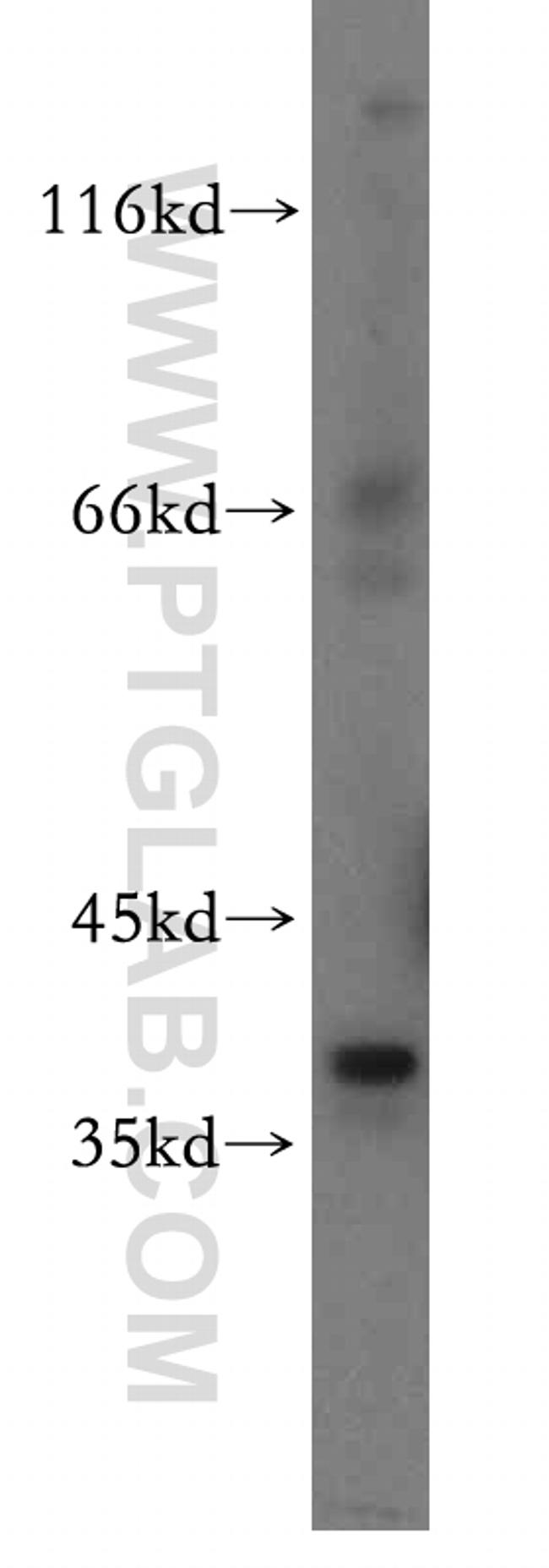 MAT2B Antibody in Western Blot (WB)