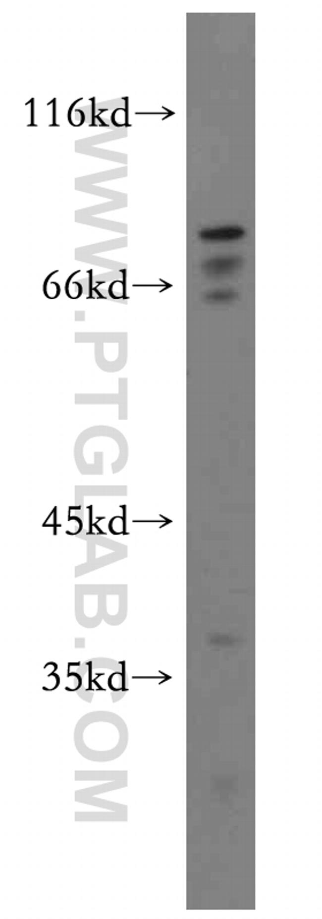 MAT2B Antibody in Western Blot (WB)