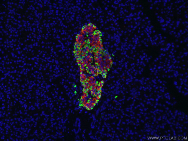 Glucagon Antibody in Immunocytochemistry (ICC/IF)