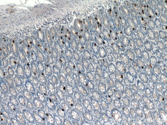 Glucagon Antibody in Immunohistochemistry (Paraffin) (IHC (P))