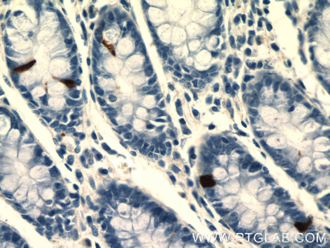 Glucagon Antibody in Immunohistochemistry (Paraffin) (IHC (P))