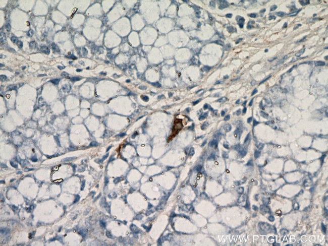 Glucagon Antibody in Immunohistochemistry (Paraffin) (IHC (P))