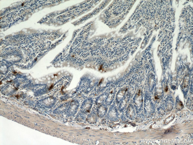 Glucagon Antibody in Immunohistochemistry (Paraffin) (IHC (P))