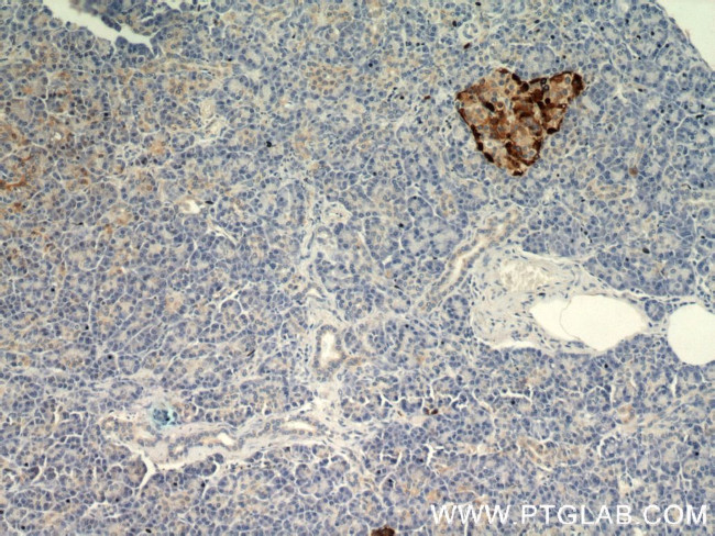 Glucagon Antibody in Immunohistochemistry (Paraffin) (IHC (P))