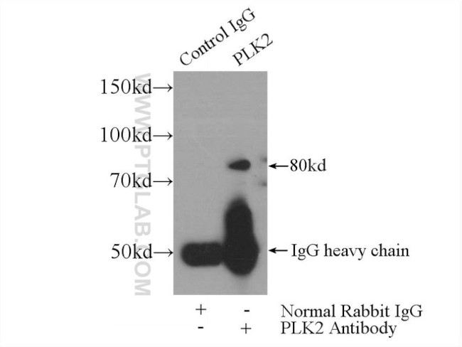 PLK2 Antibody in Immunoprecipitation (IP)