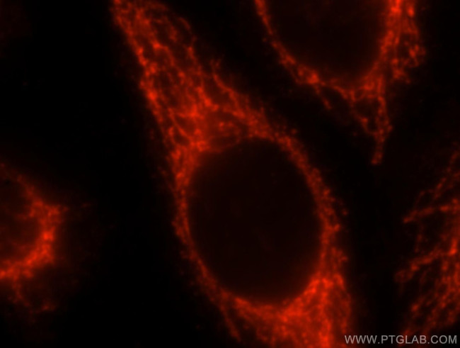 SEC24A Antibody in Immunocytochemistry (ICC/IF)