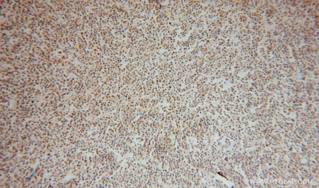 SEC24A Antibody in Immunohistochemistry (Paraffin) (IHC (P))