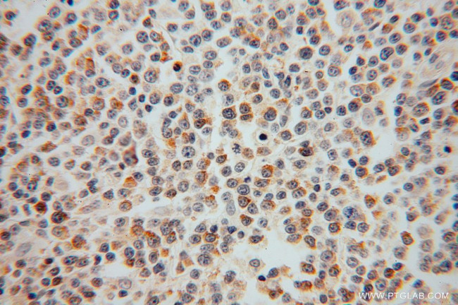 SEC24A Antibody in Immunohistochemistry (Paraffin) (IHC (P))