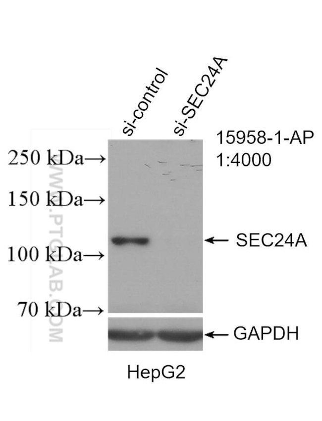 SEC24A Antibody in Western Blot (WB)