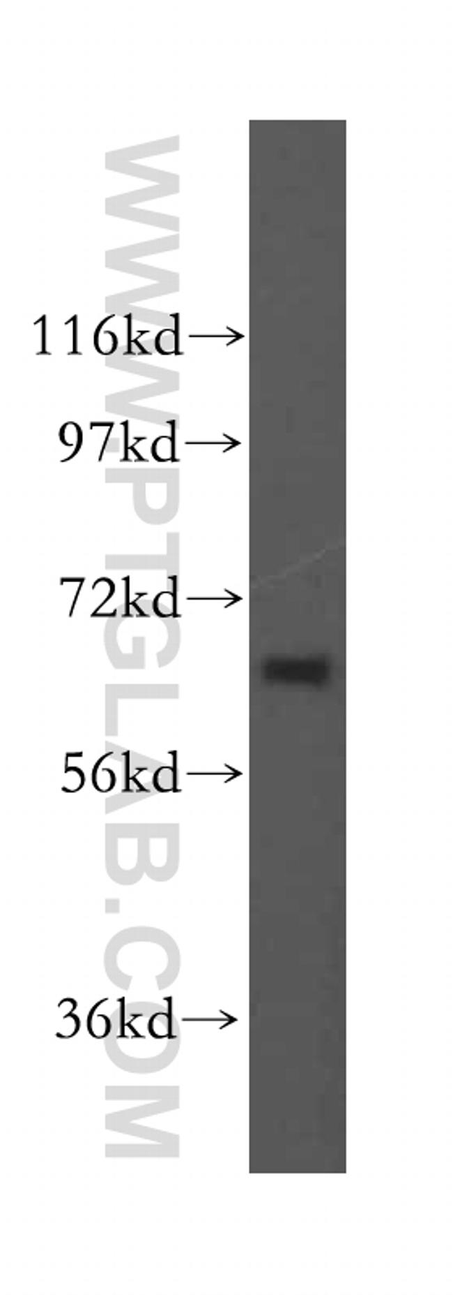 SEC24A Antibody in Western Blot (WB)