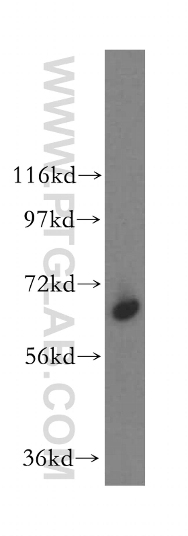 SEC24A Antibody in Western Blot (WB)