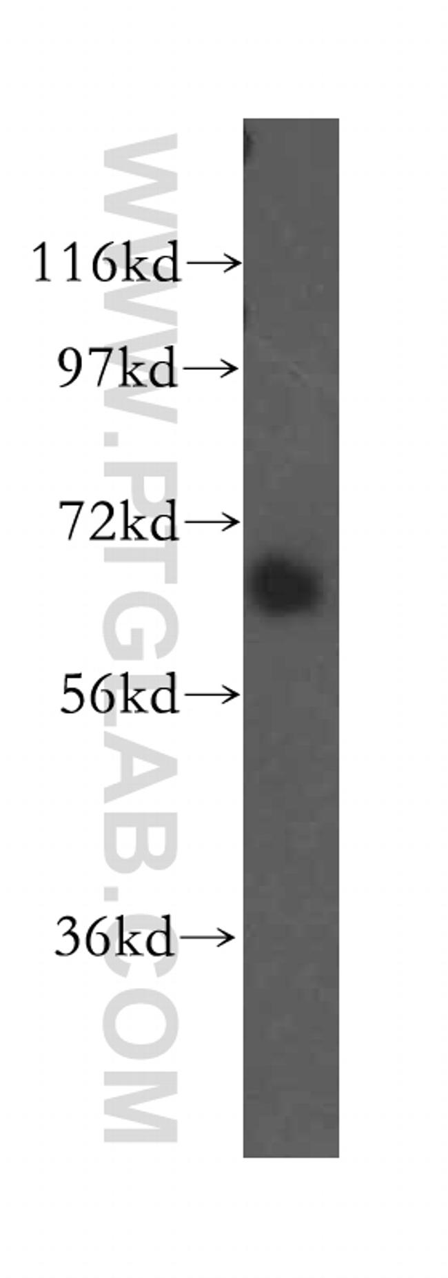 SEC24A Antibody in Western Blot (WB)