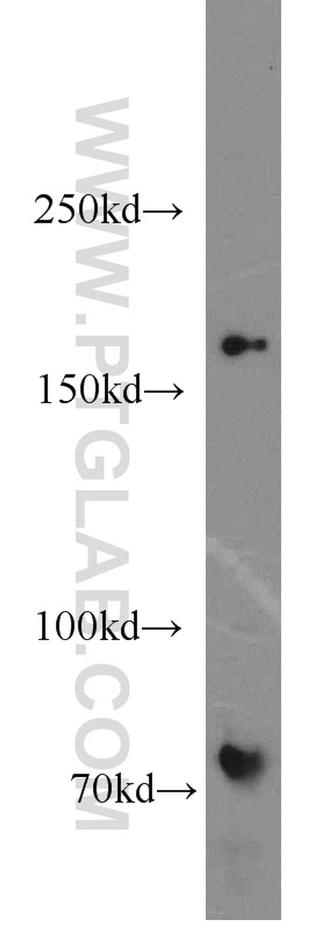 MBD5 Antibody in Western Blot (WB)