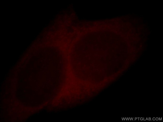 Cystatin A Antibody in Immunocytochemistry (ICC/IF)