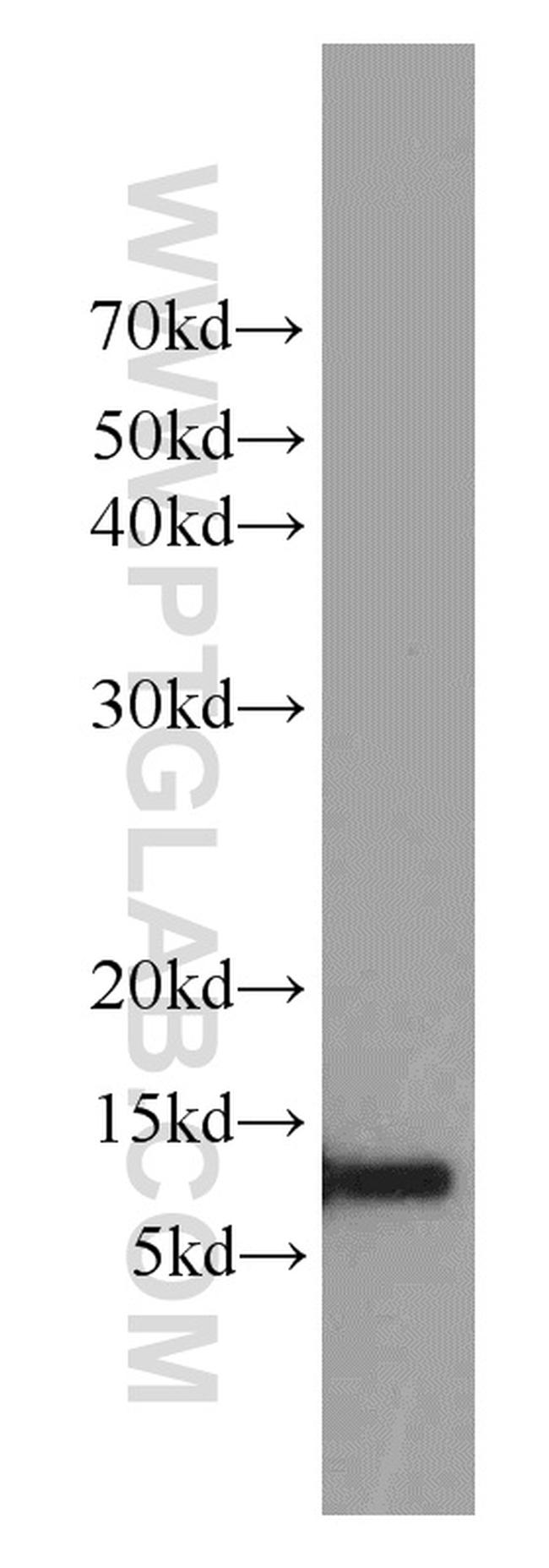 Cystatin A Antibody in Western Blot (WB)